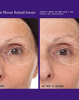 Lunar Bloom Retinal Serum