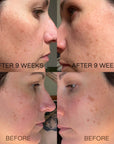 18% Vitamin C + E Booster Serum