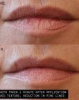 Lip Ointment Hydrating Lip Treatment