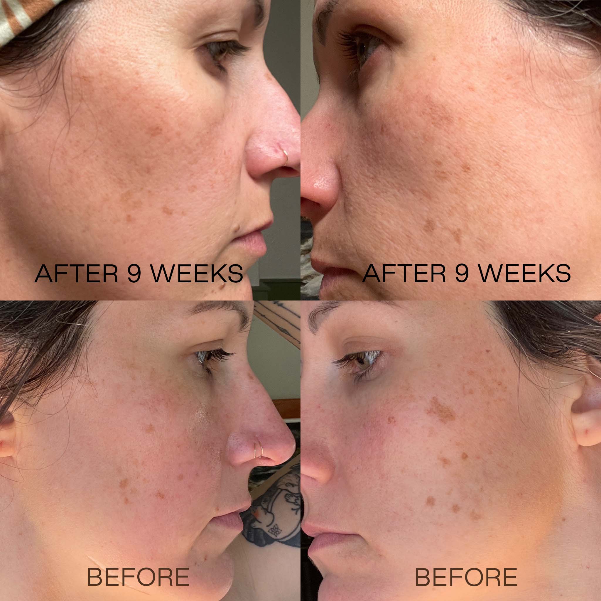 18% Vitamin C + E Booster Serum | Gentle, Effective Vitamin C for