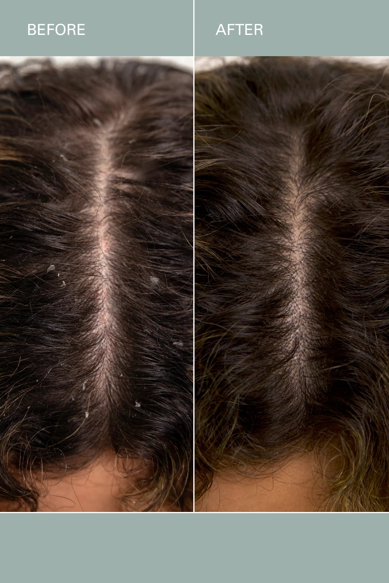 Salt Scalp Scrub Exfoliating Shampoo